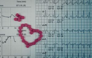 Cardiac Monitoring App Revolutionizes Heart Health